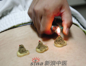 灸法的種類(lèi)  你知道多少？