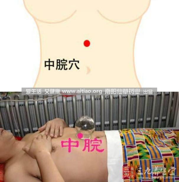 中脘穴位于腹部正中線(xiàn)，臍上4寸的位置上。每天艾灸10-15分鐘，能有效緩解胃部不適的癥狀，同時(shí)有助于祛濕。